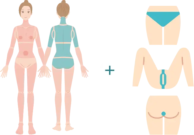 BEAUTY SKIN CLINIC（ビューティースキンクリニック） 最新型ジェントルマックスプロプラス