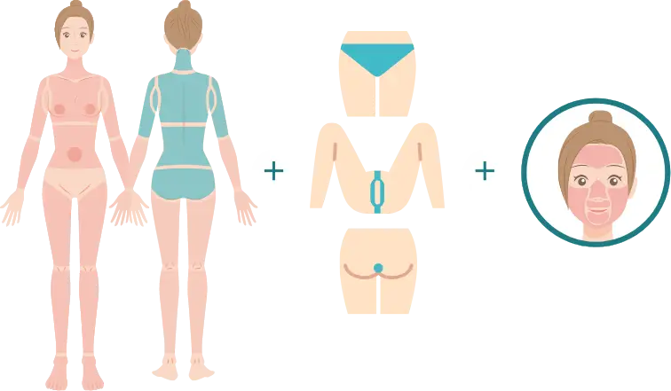 BEAUTY SKIN CLINIC（ビューティースキンクリニック） 最新型ジェントルマックスプロプラス