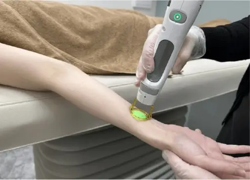 BEAUTY SKIN CLINIC（ビューティースキンクリニック） 最新型ジェントルマックスプロプラス