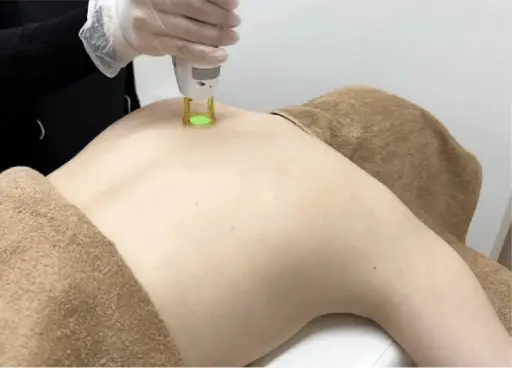 BEAUTY SKIN CLINIC（ビューティースキンクリニック） 最新型ジェントルマックスプロプラス