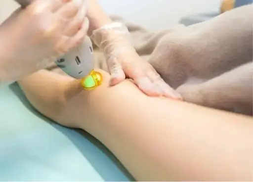 BEAUTY SKIN CLINIC（ビューティースキンクリニック） 最新型ジェントルマックスプロプラス