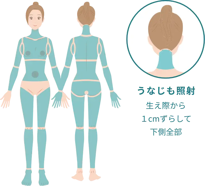 BEAUTY SKIN CLINIC（ビューティースキンクリニック） 最新型ジェントルマックスプロプラス