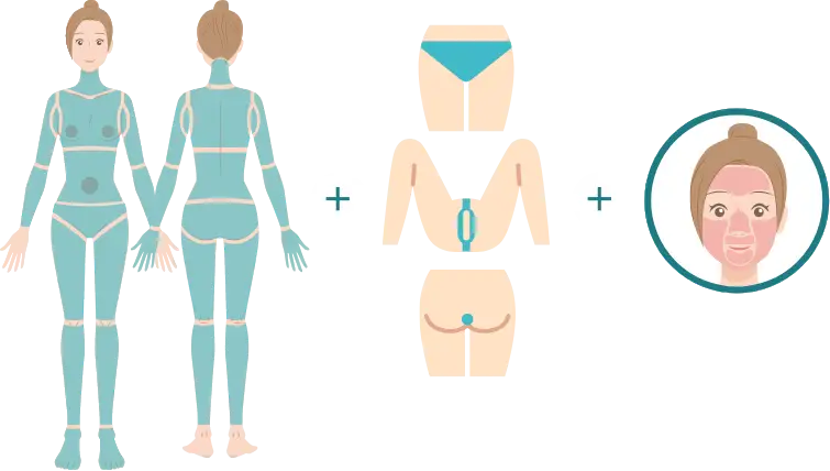 BEAUTY SKIN CLINIC（ビューティースキンクリニック） 最新型ジェントルマックスプロプラス