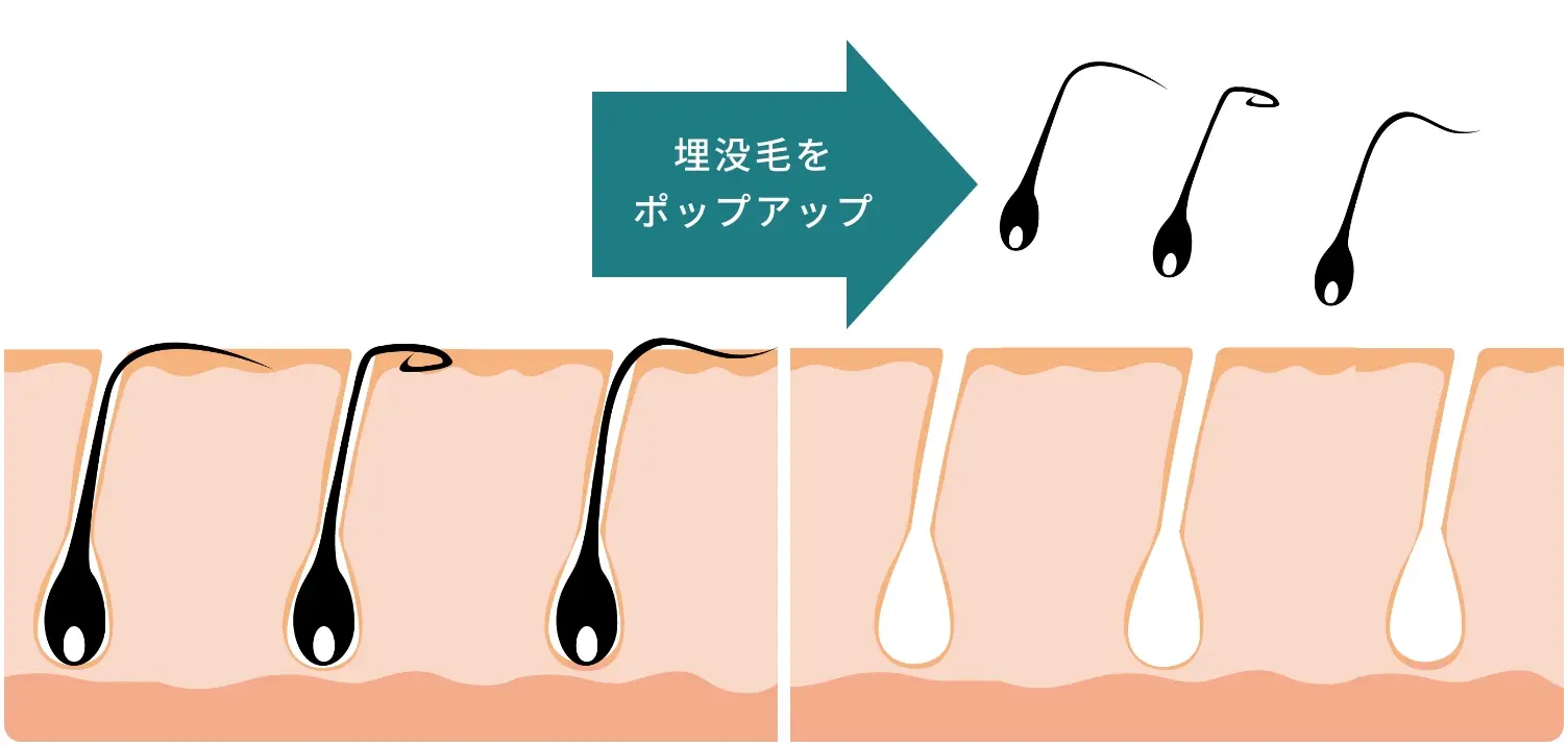 BEAUTY SKIN CLINIC（ビューティースキンクリニック） 脚医療脱毛セット