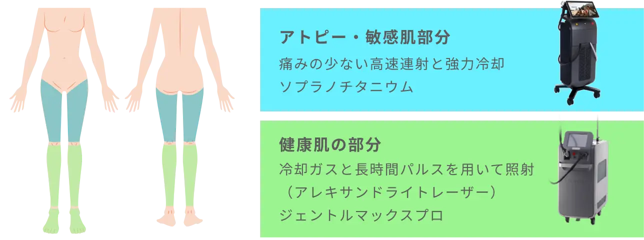 BEAUTY SKIN CLINIC（ビューティースキンクリニック） 脚医療脱毛セット