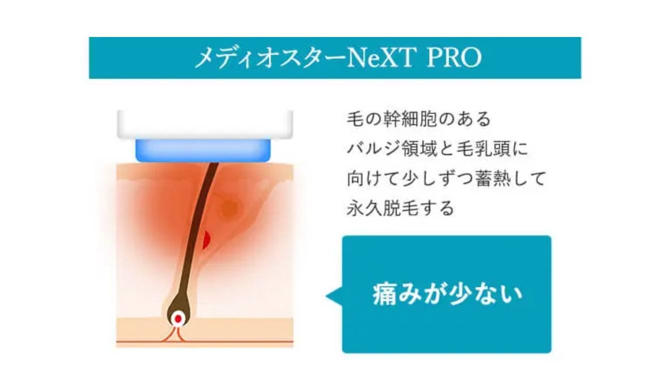 BEAUTY SKIN CLINIC（ビューティースキンクリニック） メディオスターNEXT PRO