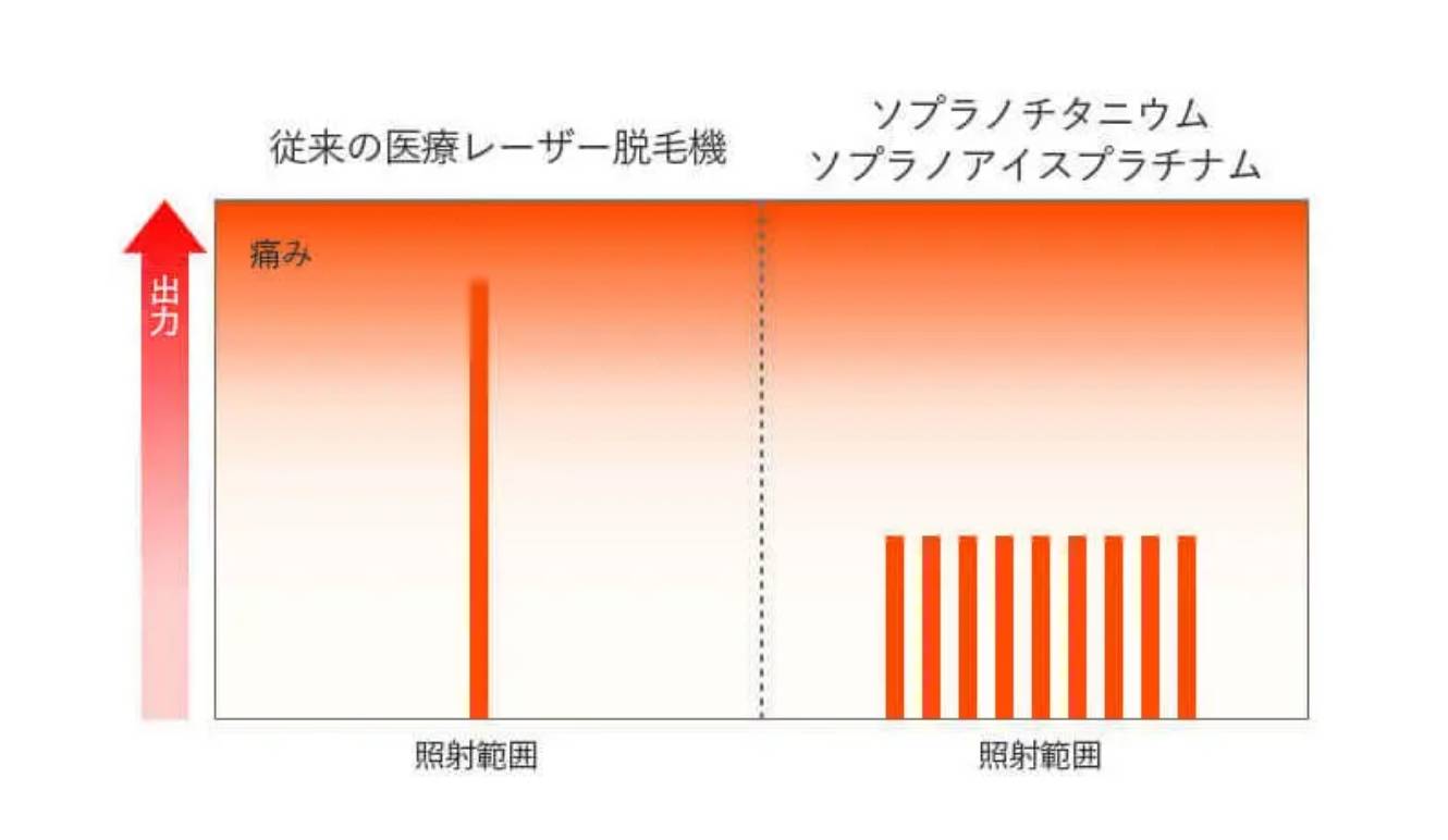 BEAUTY SKIN CLINIC（ビューティースキンクリニック） ソプラノチタニウム