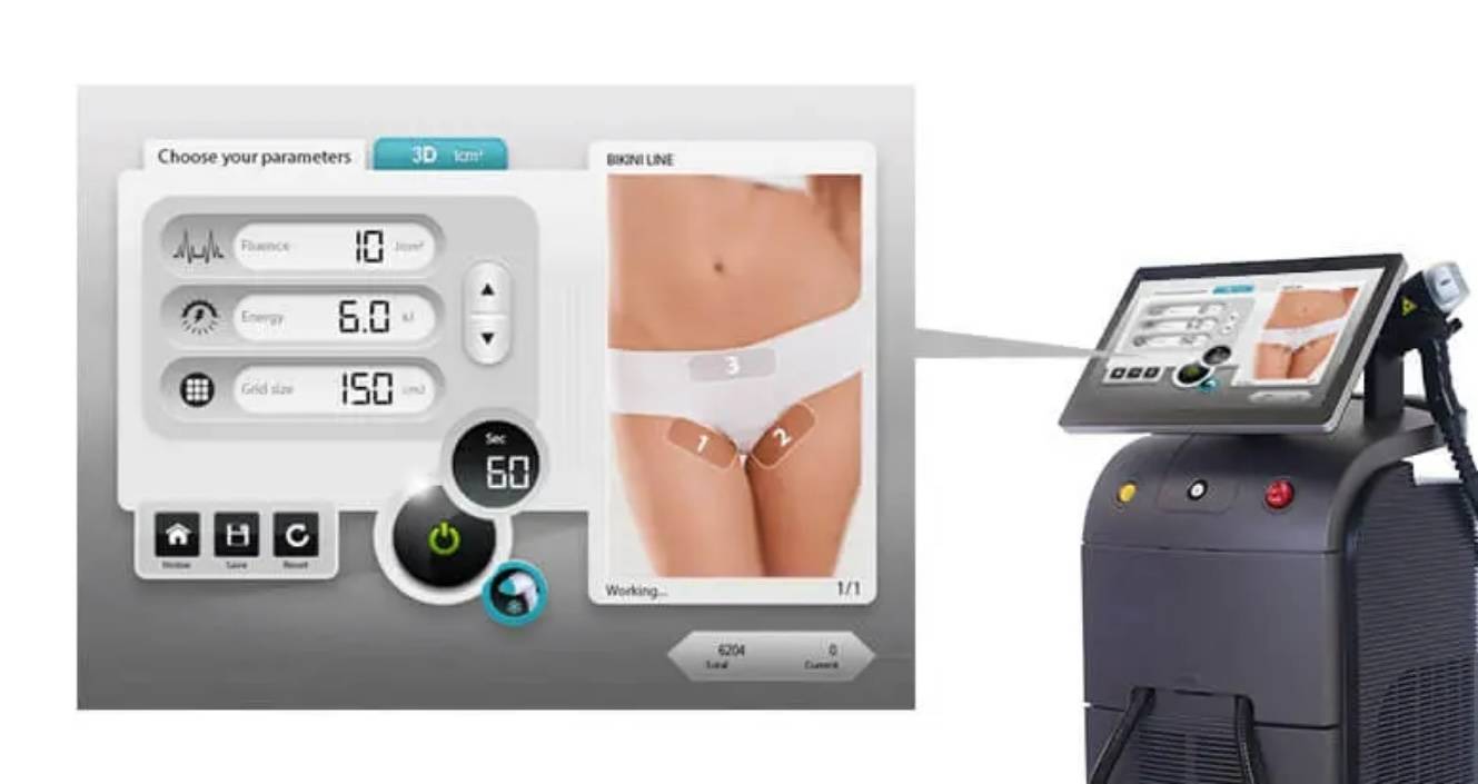 BEAUTY SKIN CLINIC（ビューティースキンクリニック） ソプラノチタニウム