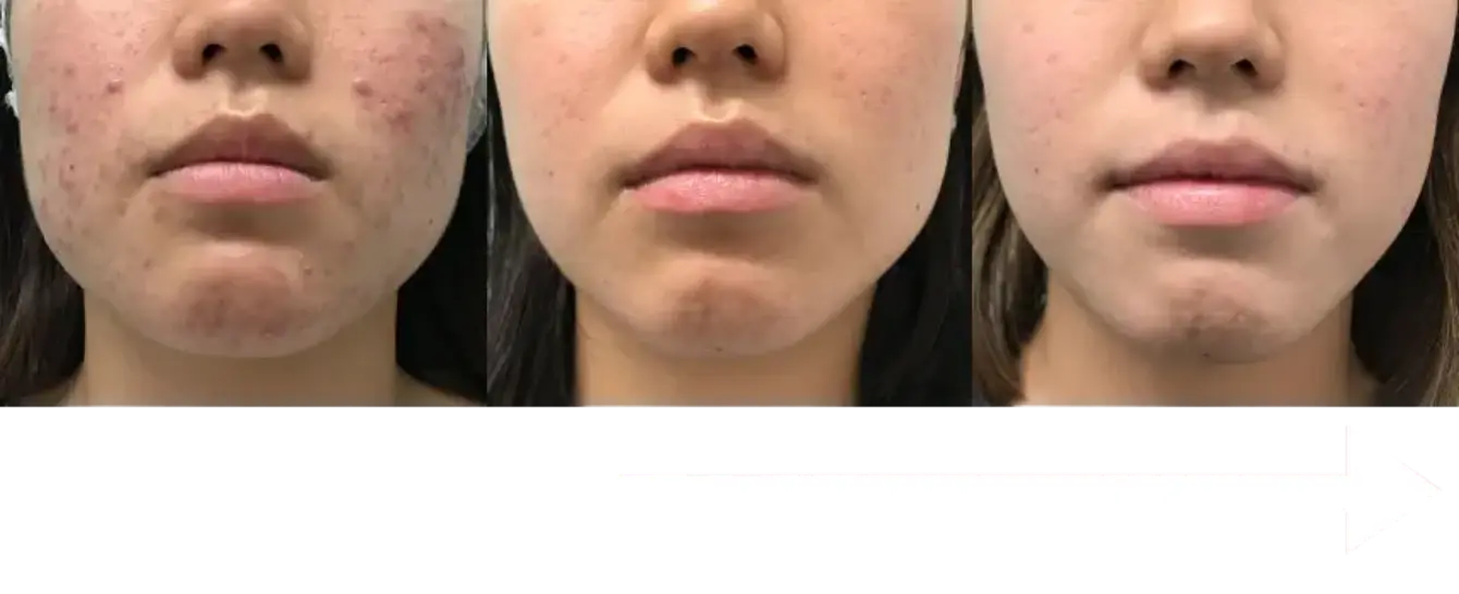 BEAUTY SKIN CLINIC（ビューティースキンクリニック） モニター募集