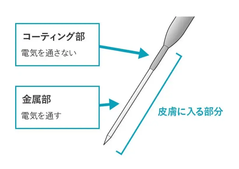 BEAUTY SKIN CLINIC(ビューティースキンクリニック) ニードル脱毛(医療針脱毛)