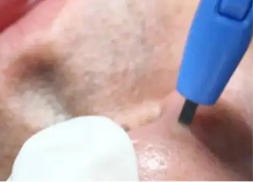 BEAUTY SKIN CLINIC（ビューティースキンクリニック）