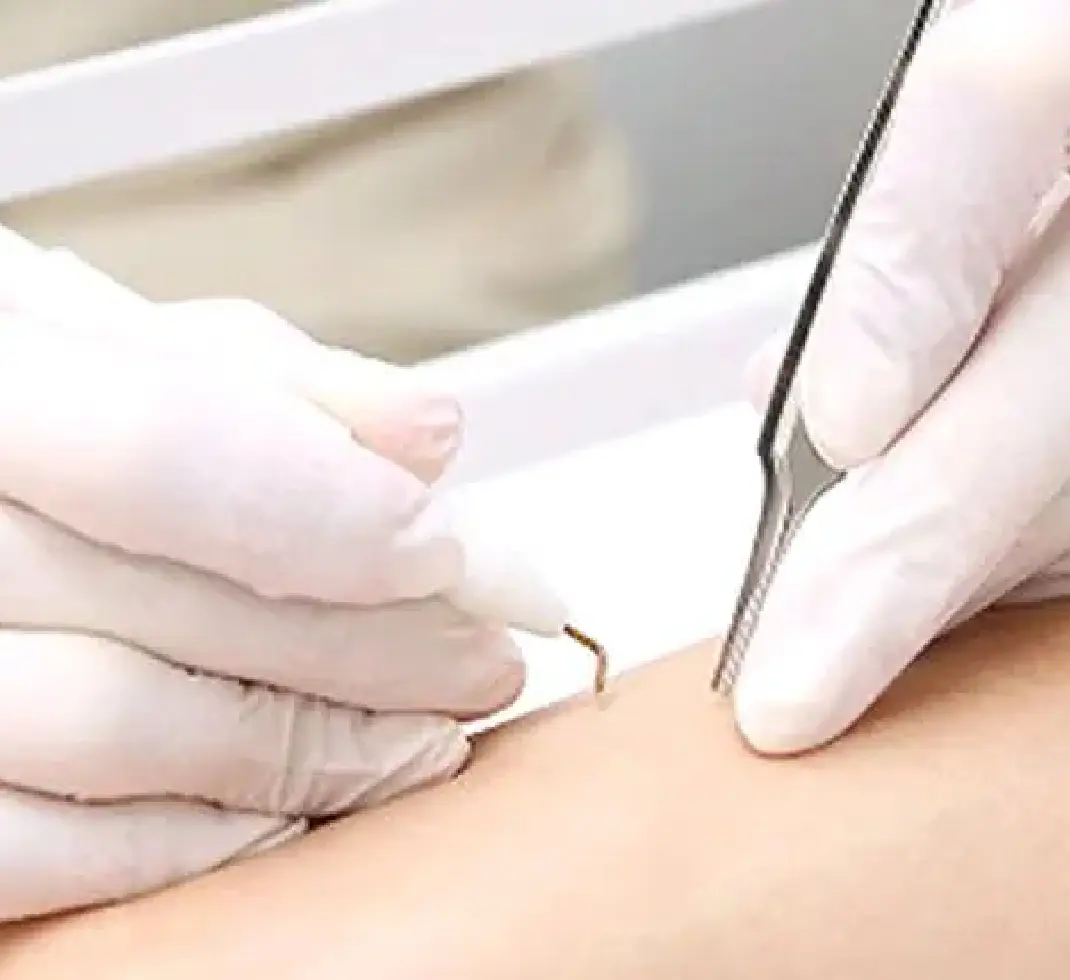 BEAUTY SKIN CLINIC（ビューティースキンクリニック） ニキビ治療専門クリニック