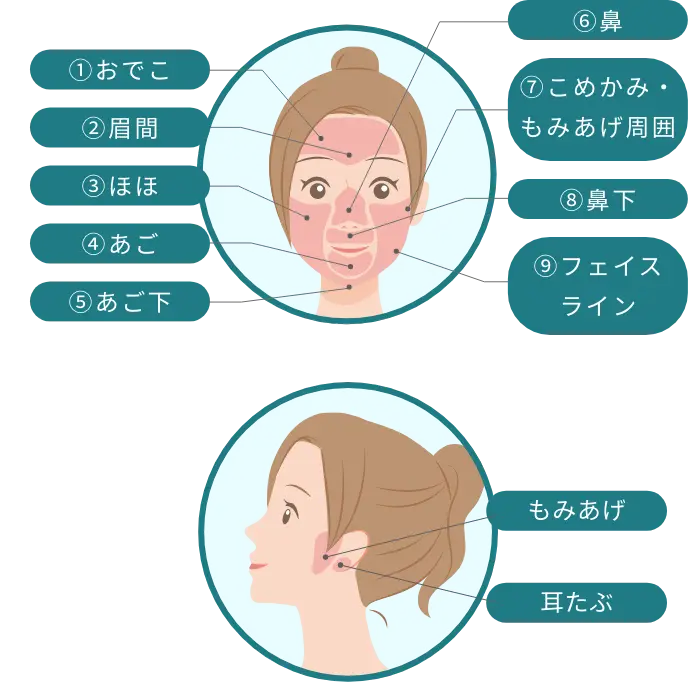 BEAUTY SKIN CLINIC（ビューティースキンクリニック） パーツ別医療脱毛