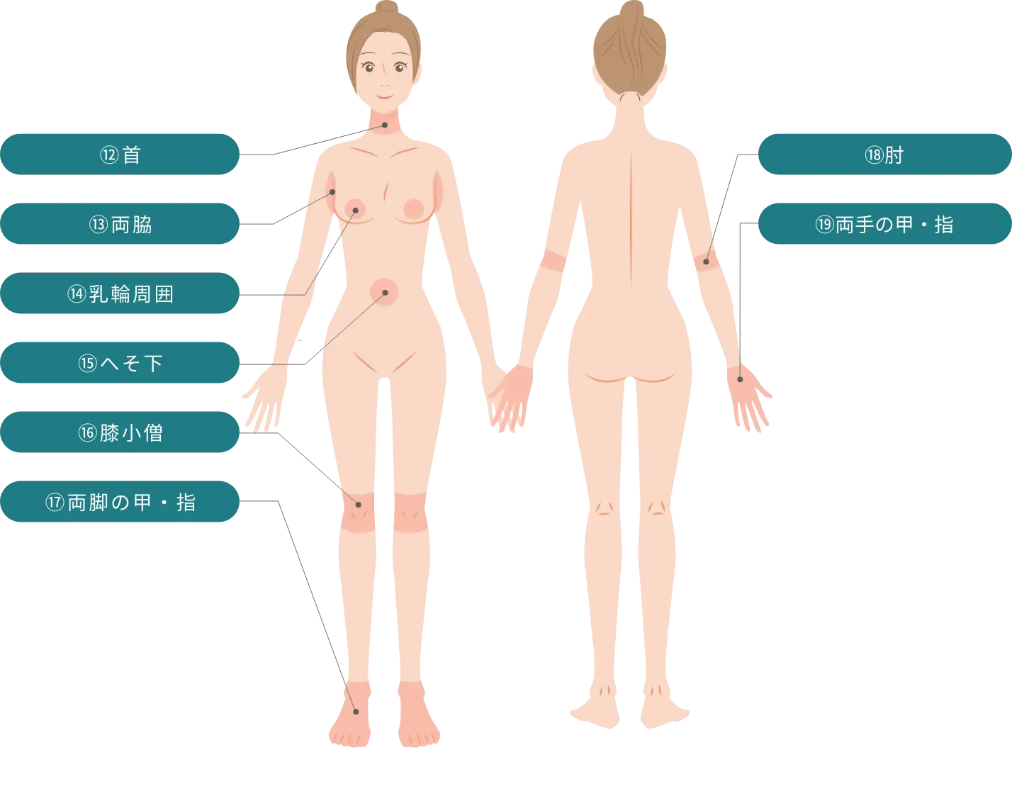BEAUTY SKIN CLINIC（ビューティースキンクリニック） パーツ別医療脱毛