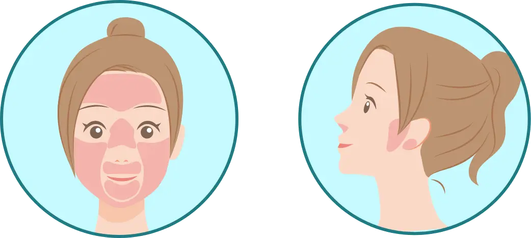 BEAUTY SKIN CLINIC（ビューティースキンクリニック） パーツ別医療脱毛