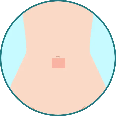 BEAUTY SKIN CLINIC（ビューティースキンクリニック） パーツ別医療脱毛