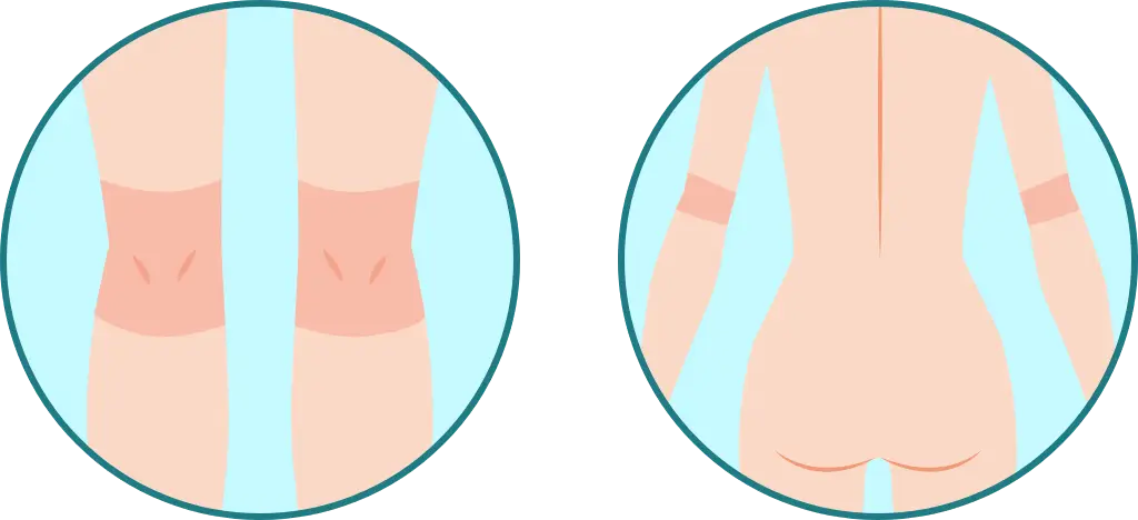 BEAUTY SKIN CLINIC（ビューティースキンクリニック） パーツ別医療脱毛