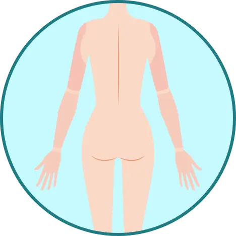 BEAUTY SKIN CLINIC（ビューティースキンクリニック） パーツ別医療脱毛