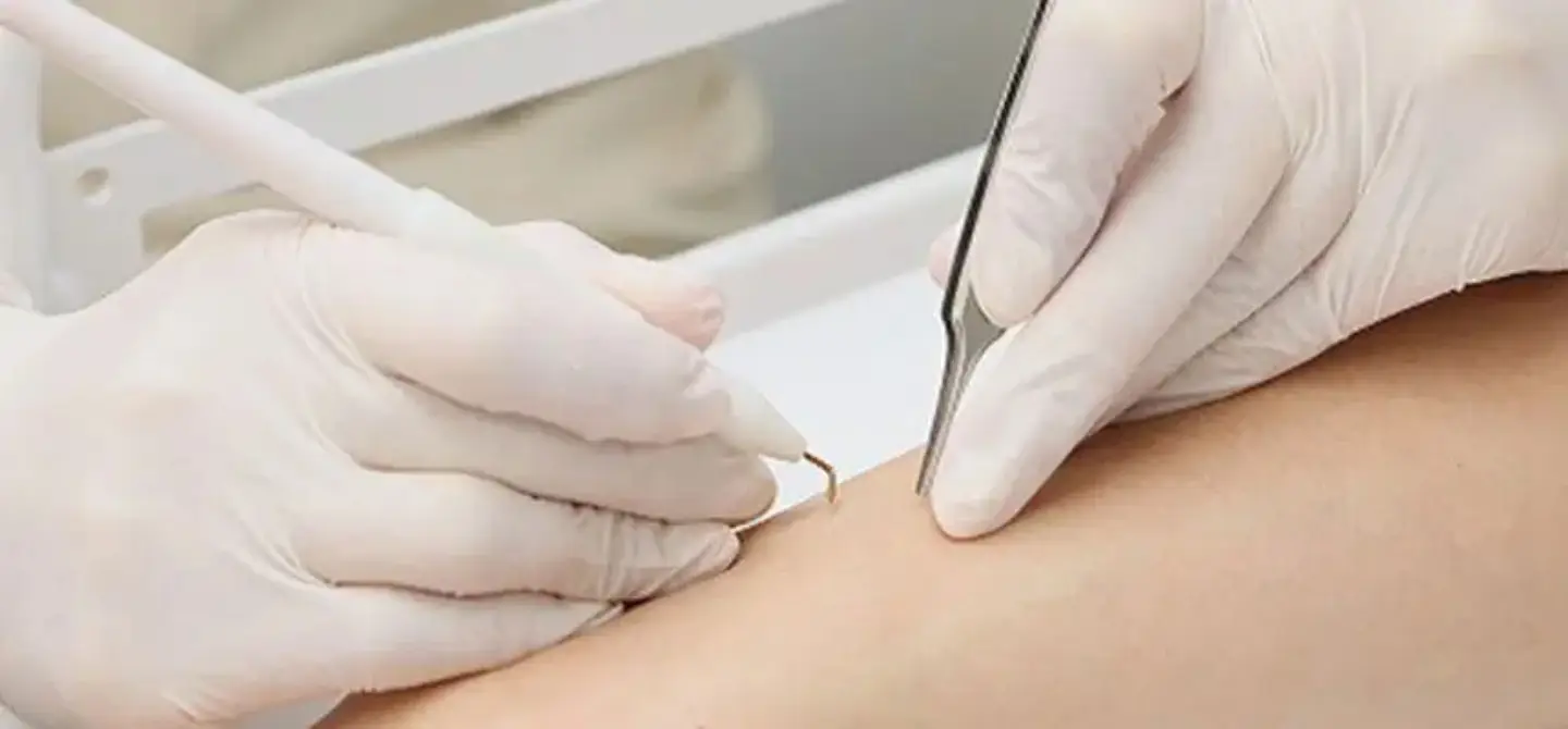 BEAUTY SKIN CLINIC（ビューティースキンクリニック） 当院が選ばれる理由