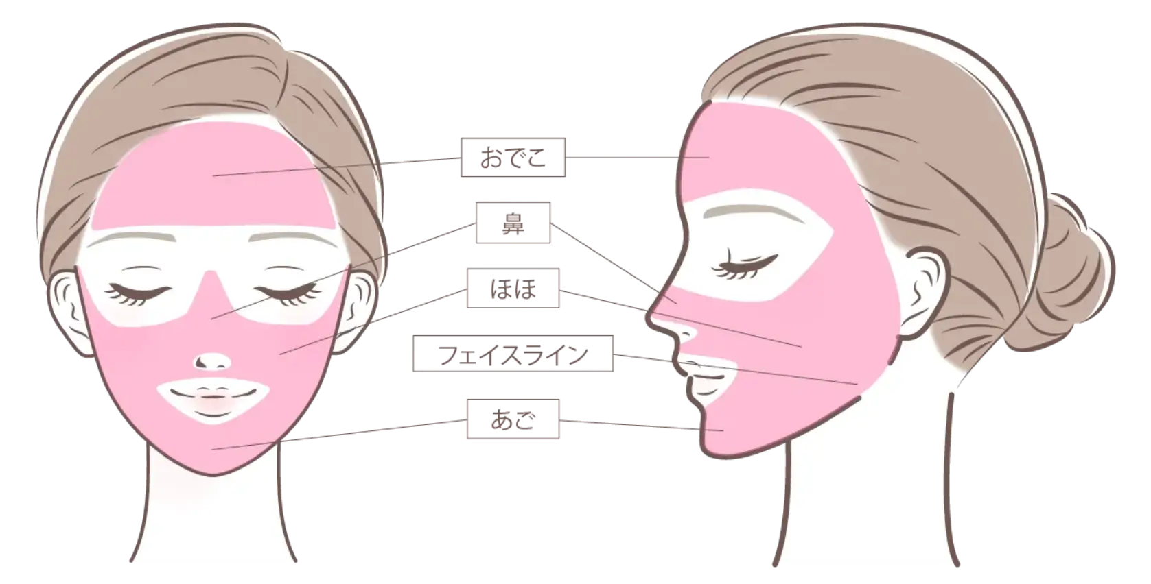 トーニング・フラクショナル・スポットの照射範囲