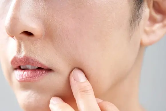 BEAUTY SKIN CLINIC(ビューティースキンクリニック)最新機種 ピコシュアプロ