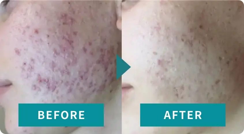 BEAUTY SKIN CLINIC(ビューティースキンクリニック) スーパーヴェルヴェットスキン