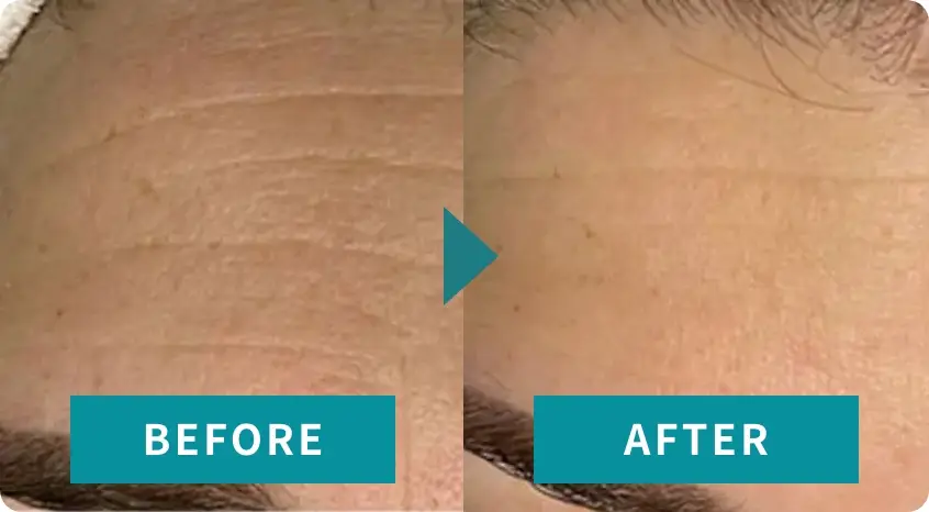 BEAUTY SKIN CLINIC(ビューティースキンクリニック) スーパーヴェルヴェットスキン