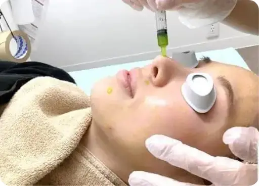 BEAUTY SKIN CLINIC（ビューティースキンクリニック） スーパーヴェルヴェットスキン