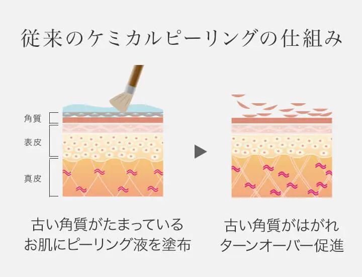 BEAUTY SKIN CLINIC（ビューティースキンクリニック） スーパーヴェルヴェットスキン