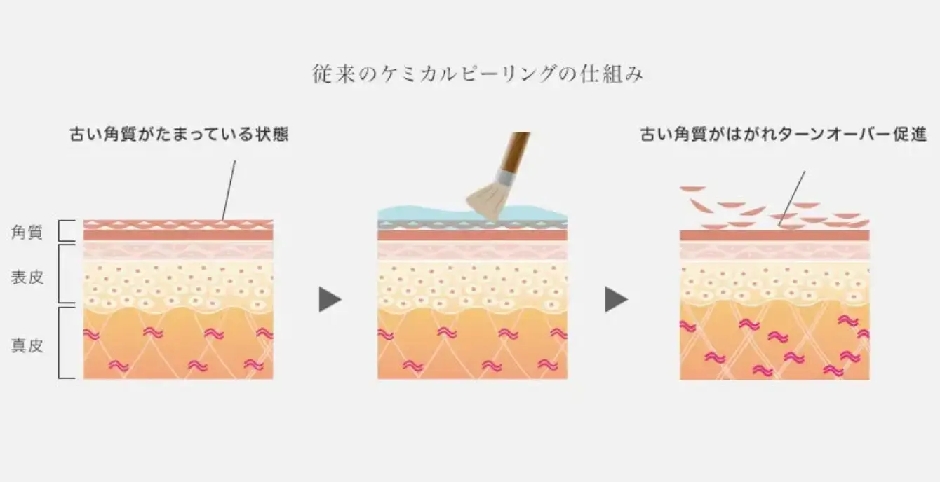 BEAUTY SKIN CLINIC（ビューティースキンクリニック） スーパーヴェルヴェットスキン