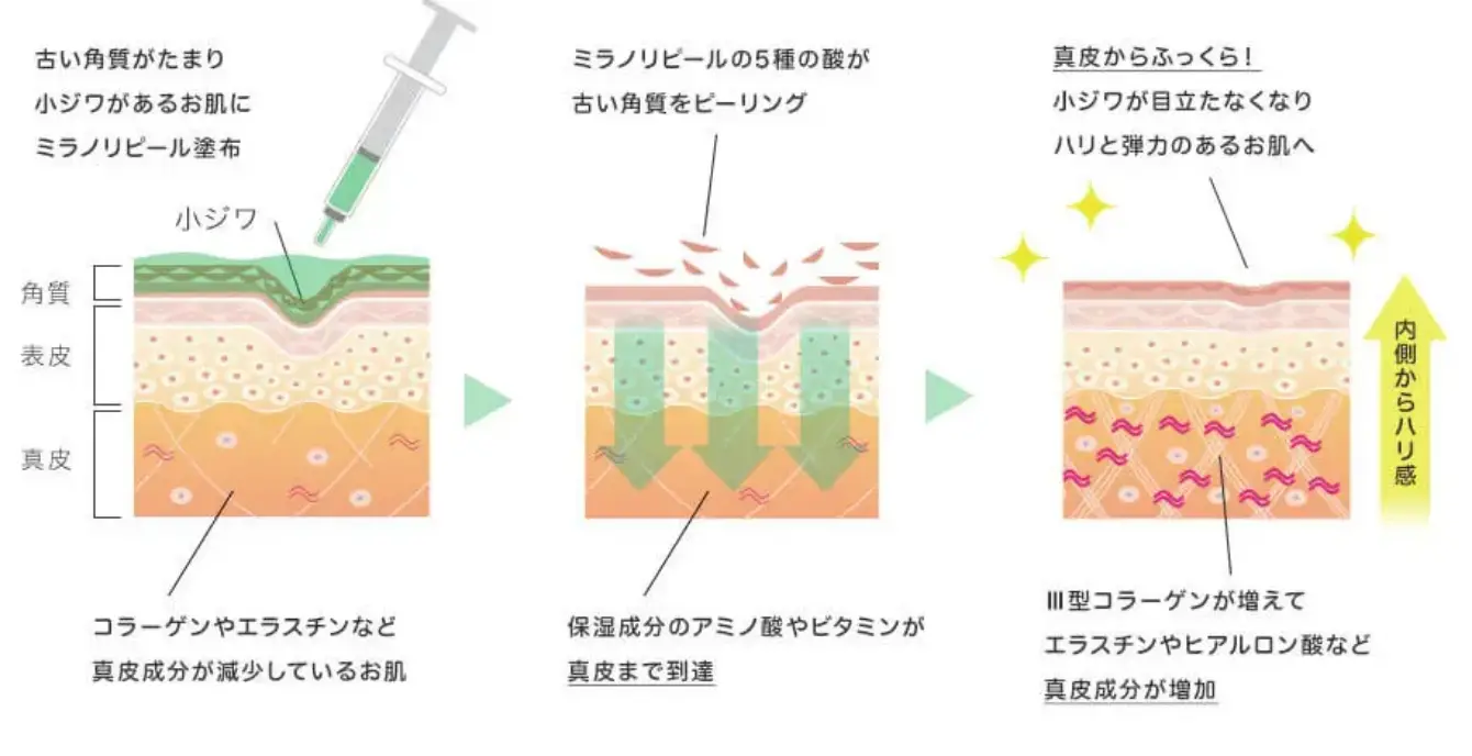 BEAUTY SKIN CLINIC（ビューティースキンクリニック） スーパーヴェルヴェットスキン