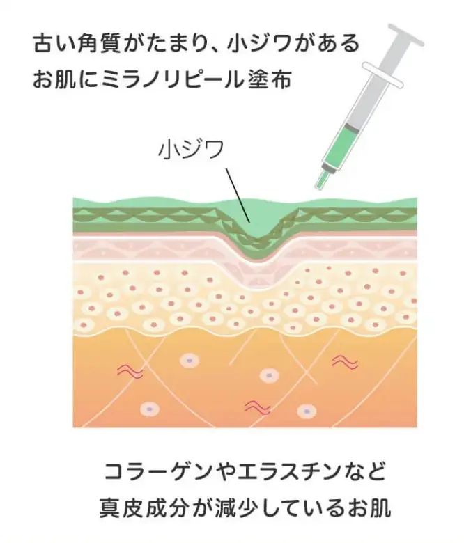 BEAUTY SKIN CLINIC（ビューティースキンクリニック） スーパーヴェルヴェットスキン