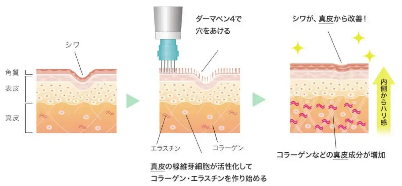 BEAUTY SKIN CLINIC（ビューティースキンクリニック） スーパーヴェルヴェットスキン