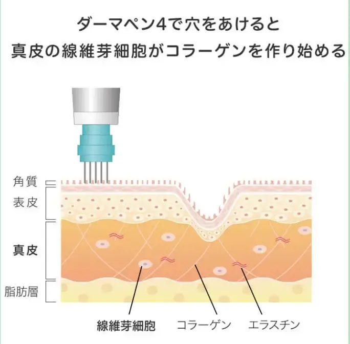 BEAUTY SKIN CLINIC（ビューティースキンクリニック） スーパーヴェルヴェットスキン