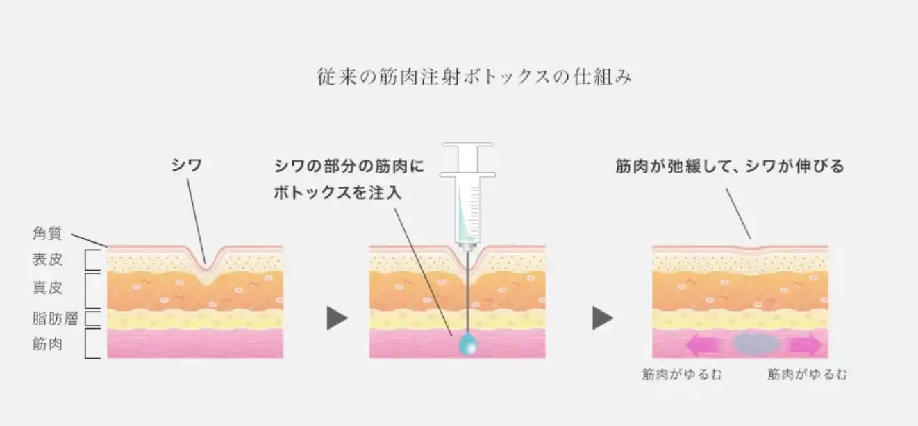 BEAUTY SKIN CLINIC（ビューティースキンクリニック） スーパーヴェルヴェットスキン