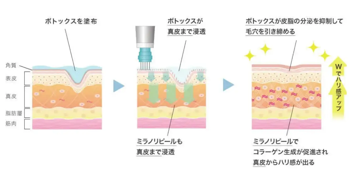 BEAUTY SKIN CLINIC（ビューティースキンクリニック） スーパーヴェルヴェットスキン