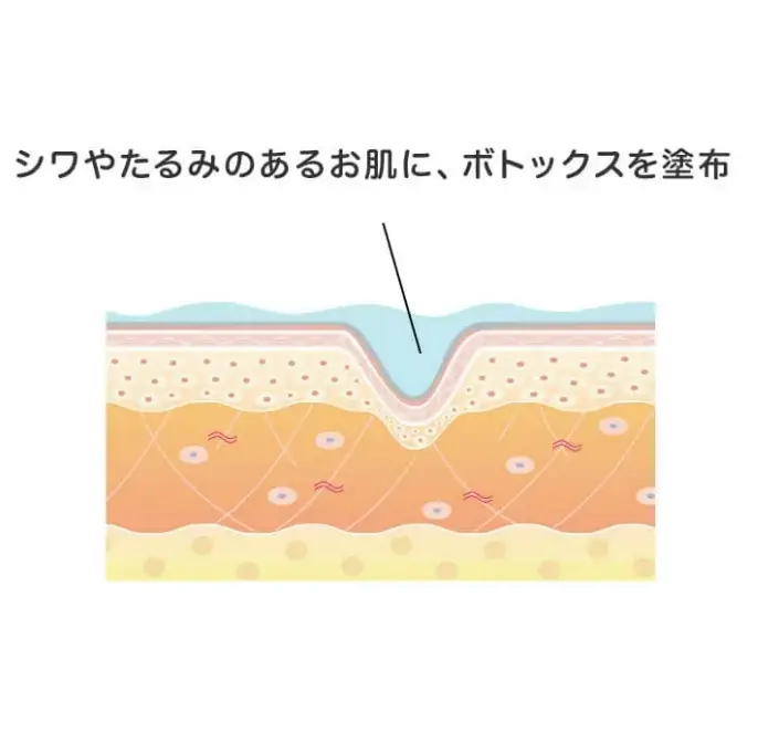 BEAUTY SKIN CLINIC（ビューティースキンクリニック） スーパーヴェルヴェットスキン