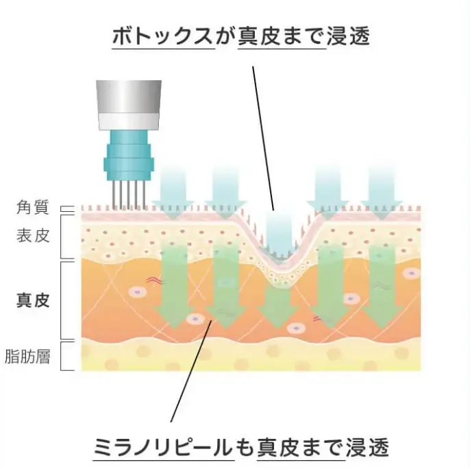 BEAUTY SKIN CLINIC（ビューティースキンクリニック） スーパーヴェルヴェットスキン
