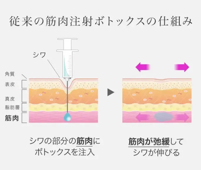 BEAUTY SKIN CLINIC（ビューティースキンクリニック） スーパーヴェルヴェットスキン