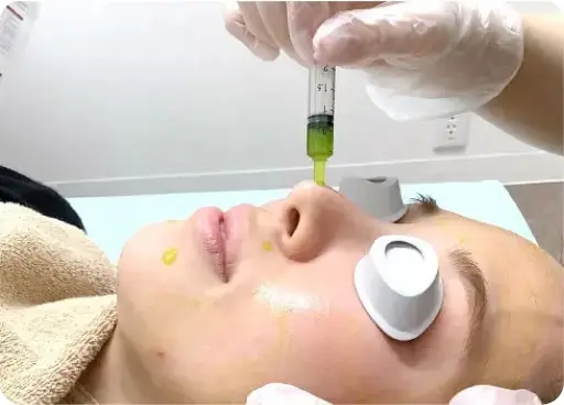 BEAUTY SKIN CLINIC（ビューティースキンクリニック） スーパーヴェルヴェットスキン