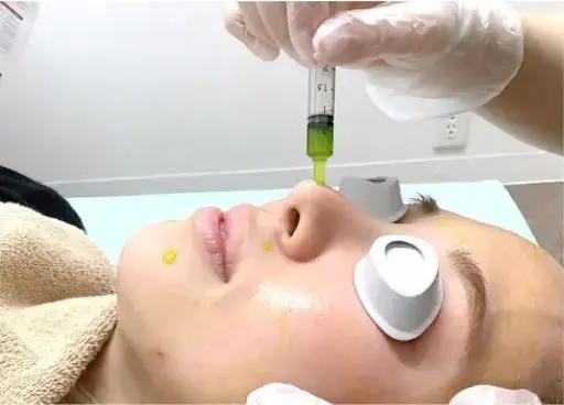 BEAUTY SKIN CLINIC（ビューティースキンクリニック） スーパーヴェルヴェットスキン