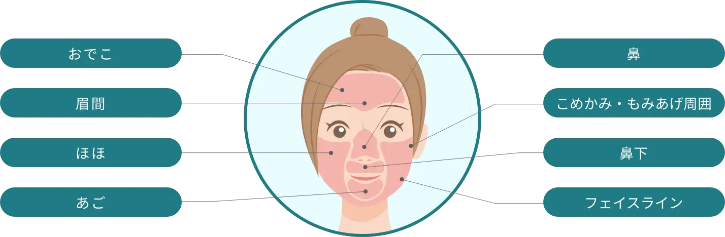 BEAUTY SKIN CLINIC（ビューティースキンクリニック） スーパーヴェルヴェットスキン