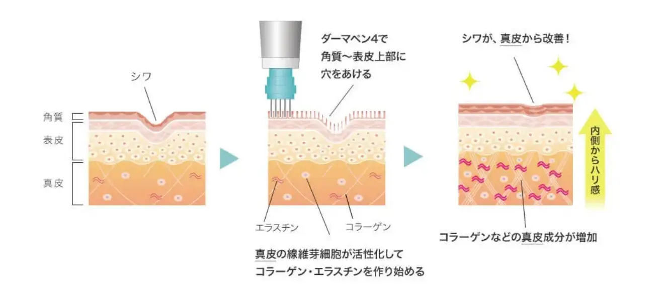 BEAUTY SKIN CLINIC（ビューティースキンクリニック） ヴェルヴェットスキン