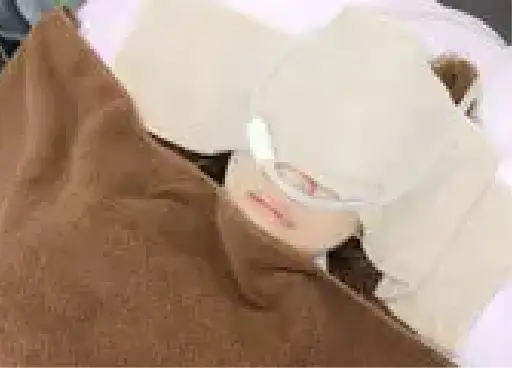 BEAUTY SKIN CLINIC（ビューティースキンクリニック） VIOパーフェクト医療脱毛セット