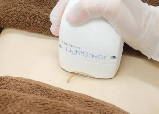 BEAUTY SKIN CLINIC（ビューティースキンクリニック） VIOパーフェクト医療脱毛セット