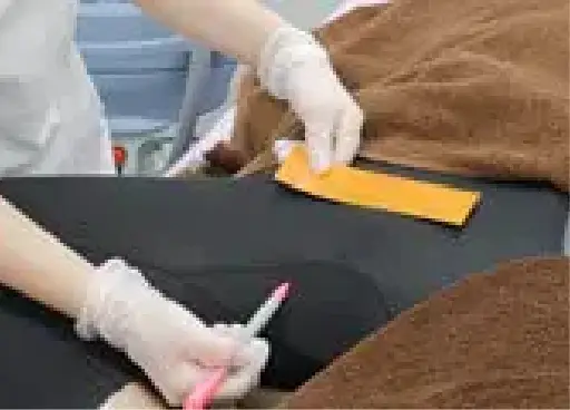 BEAUTY SKIN CLINIC（ビューティースキンクリニック） VIOパーフェクト医療脱毛セット