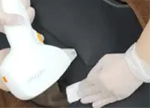 BEAUTY SKIN CLINIC（ビューティースキンクリニック） VIOパーフェクト医療脱毛セット