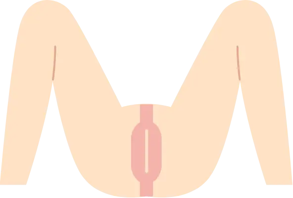 BEAUTY SKIN CLINIC（ビューティースキンクリニック） VIOパーフェクト医療脱毛セット