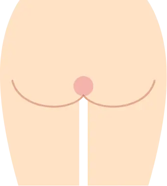 BEAUTY SKIN CLINIC（ビューティースキンクリニック） VIOパーフェクト医療脱毛セット