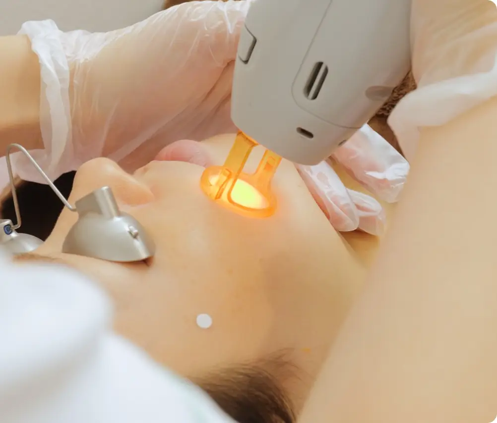 BEAUTY SKIN CLINIC（ビューティースキンクリニック） VIOパーフェクト医療脱毛セット